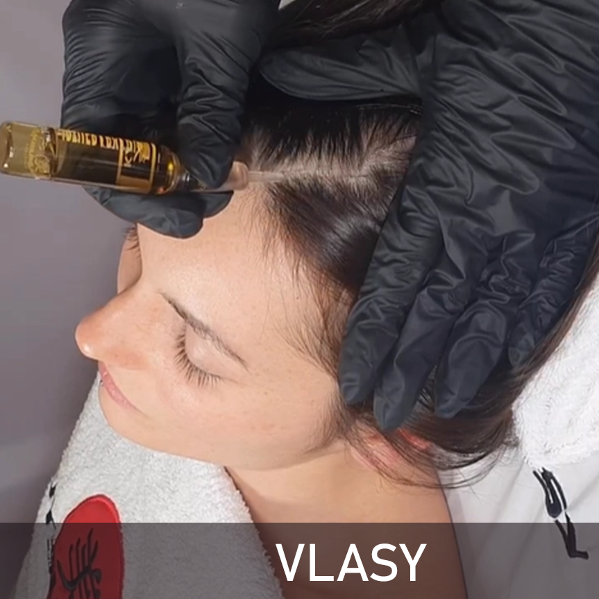 VLASY